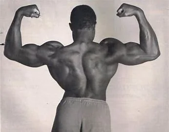Powerlifter Lamar Gant shown here with idiopathic scoliosis, curvature of the spine.